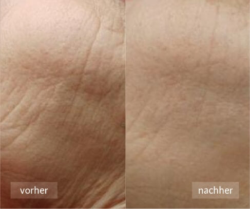 SOMIU skin repair: Sichtbare Verbesserungen nach wenigen Schritten.